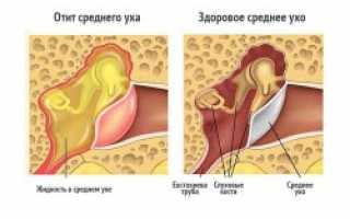 Причины и лечение нарушений слуха