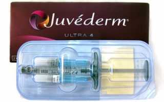 Филлеры линейки Juvederm