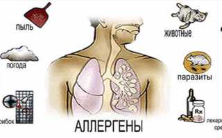 Симптомы и лечение ангионевротического отека