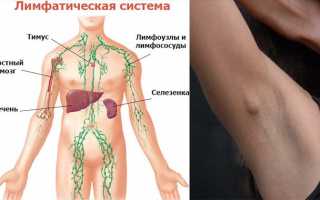 Лечение воспалившегося лимфоузла под мышкой