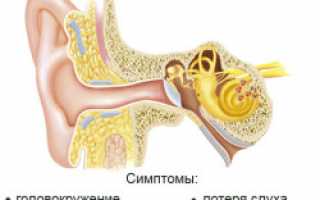 Воспалительные и невоспалительные болезни уха