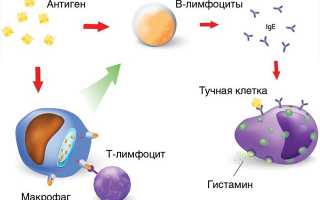 Причины, симптомы и лечение аллергического отека гортани