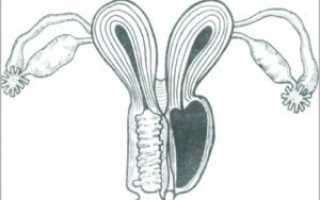 Атрезия девственной плевы – что это за болезнь?