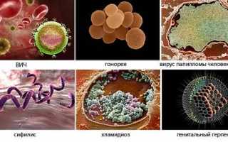 Как заражаются сифилисом?