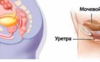 Миф о женском простатите