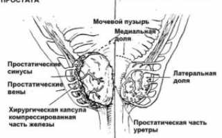 Альфа блокаторы при аденоме предстательной железы