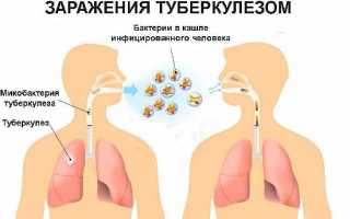 Не заразен ли туберкулез бронхов и как он проявляется