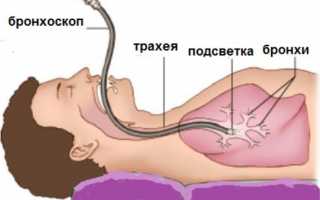 Что делать если началось легочное кровотечение