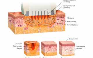 FRACTORA  — коллаген для кожи