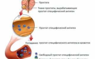 Что нужно знать об анализе ПСА при простатите?