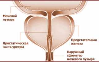 Влияние алкоголя на организм при аденоме простаты