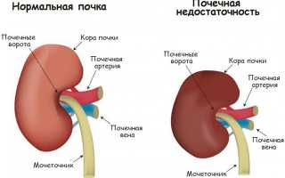 Что делать и как лечить если рука опухла