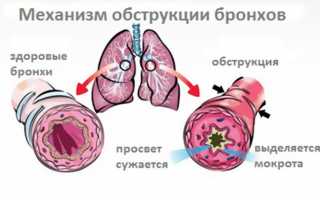 Расшифровка результатов спирографии при бронхиальной астме