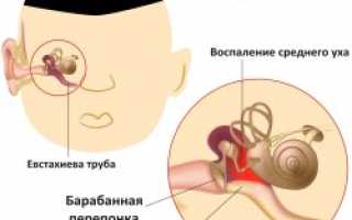 Диагноз отит: симптомы и лечение